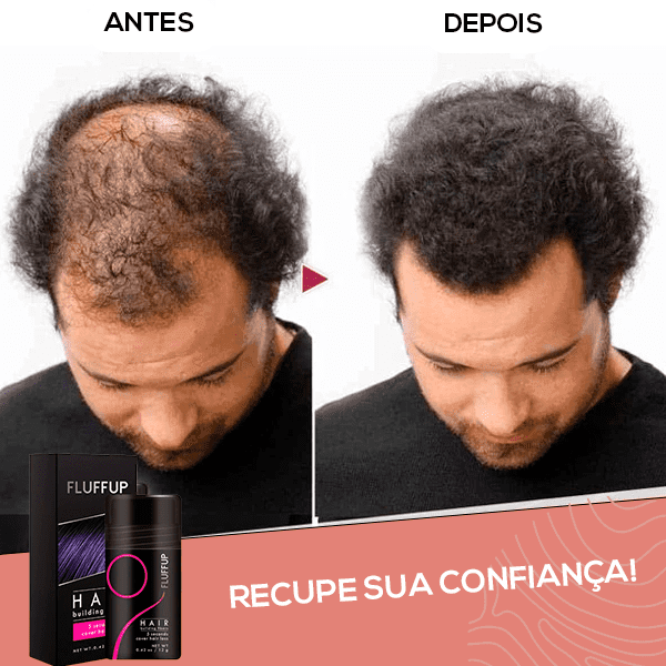 (PROMOÇÃO RELÂMPAGO [ÚLTIMO DIA] 70% OFF)  Hair Fiber - Ultra Restaurador Capilar -  (Pó - Anti-Calvice) - BrasilShopping